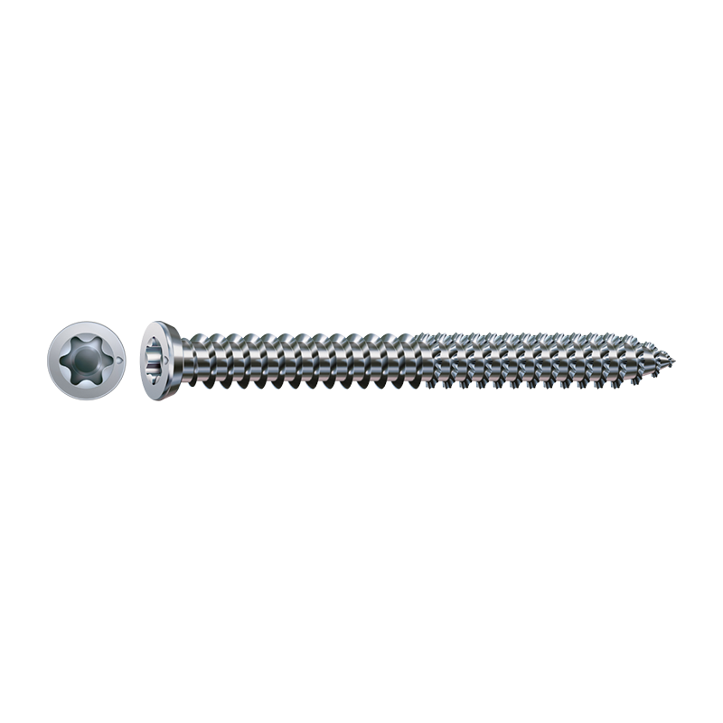 Spax-RA WIROX Countersunk T-Star Plus T30 Frame Anchor 7.5mm x 40mm
